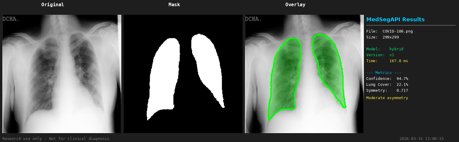 Real MedSegAPI output, showing the original chest X-ray, predicted lung mask, green segmentation overlay and model results side by side.